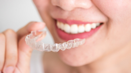 10 motivi per scegliere invisalign